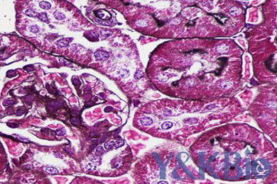 甘肃六胺银染色