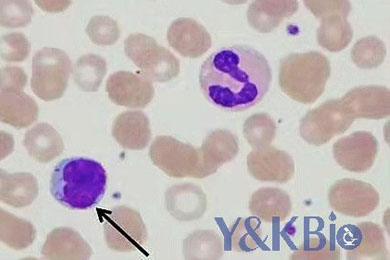 甘肃瑞氏吉姆萨染色