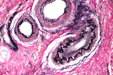 甘肃弹力纤维染色