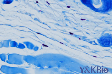 甘肃甲苯胺蓝染色