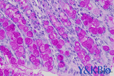 甘肃糖原PAS染色