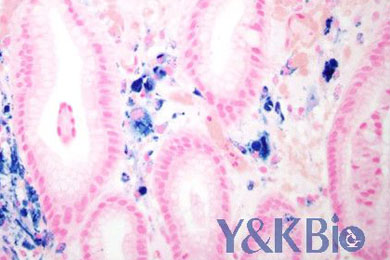 甘肃普鲁士蓝染色