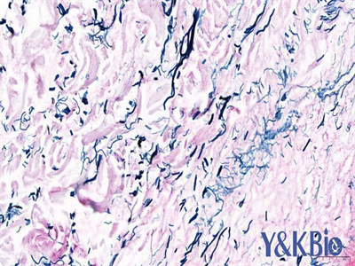 甘肃维多利亚蓝染色