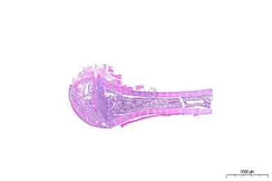 甘肃脱钙（慢脱）