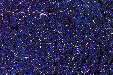 甘肃普通切片免疫荧光四标（五色）染色