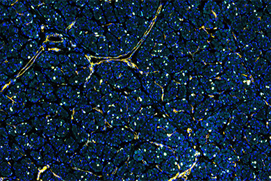 甘肃普通切片免疫荧光五标（六色）染色