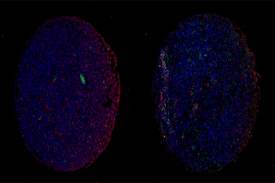 甘肃组织芯片免疫荧光单标（双色）染色