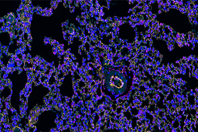 甘肃组织芯片免疫荧光双标（三色）染色