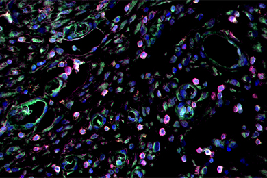 甘肃普通切片（荧光三标 四色）扫描