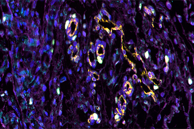 甘肃普通切片（荧光五标