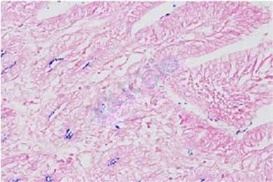 甘肃革兰氏染色