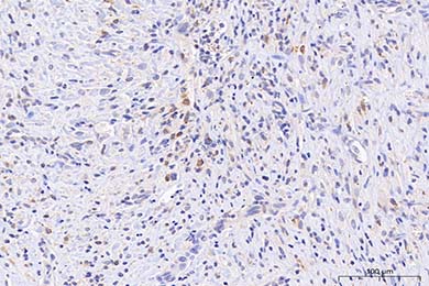 甘肃Anti-iNOS Antibody