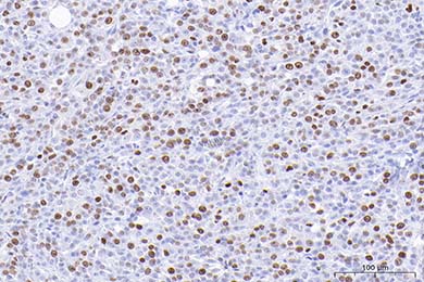 甘肃Anti-Ki67 Antibody [SR00-02]