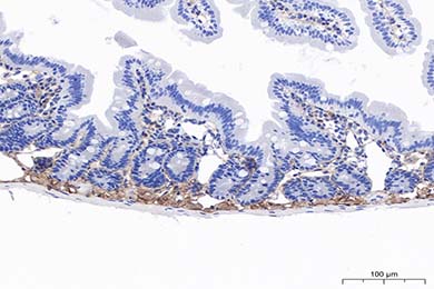 甘肃Anti-MMP-2 Antibody [PSH11-26]